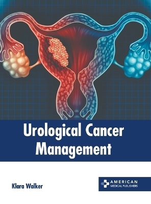 Urological Cancer Management - 