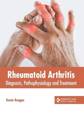 Rheumatoid Arthritis: Diagnosis, Pathophysiology and Treatment - 