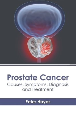 Prostate Cancer: Causes, Symptoms, Diagnosis and Treatment - 