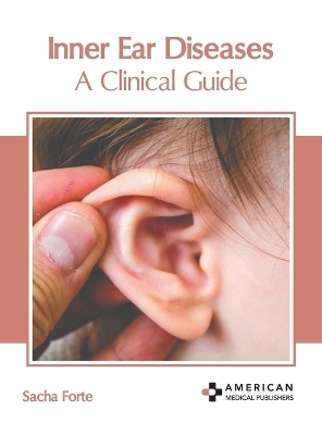 Inner Ear Diseases: A Clinical Guide - 