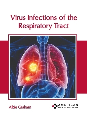 Virus Infections of the Respiratory Tract - 