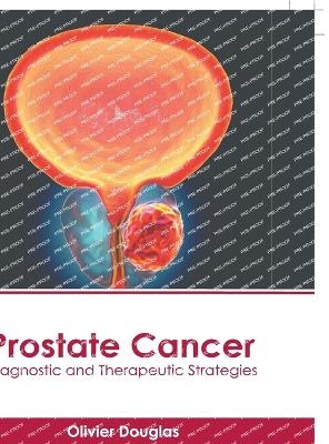 Prostate Cancer: Diagnostic and Therapeutic Strategies - 