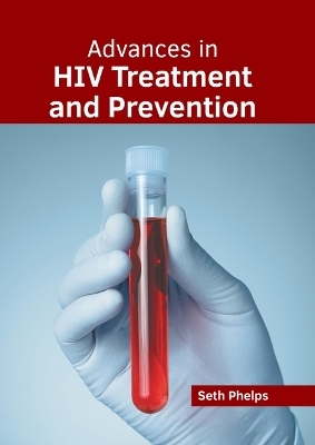 Advances in HIV Treatment and Prevention - 