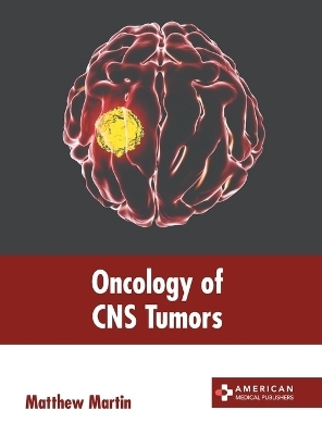 Oncology of CNS Tumors - 