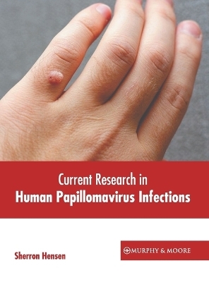 Current Research in Human Papillomavirus Infections - 