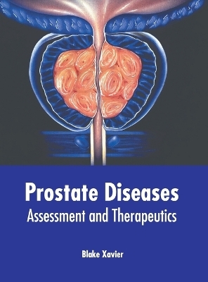 Prostate Diseases: Assessment and Therapeutics - 