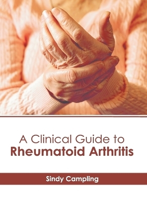 A Clinical Guide to Rheumatoid Arthritis - 