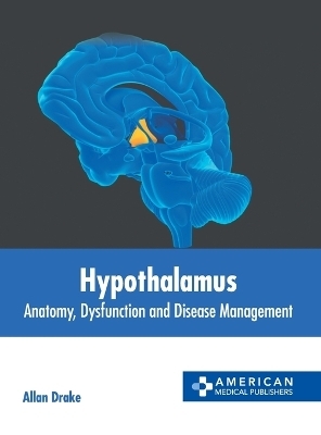 Hypothalamus: Anatomy, Dysfunction and Disease Management - 