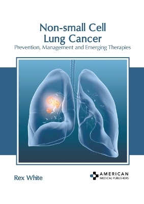 Non-Small Cell Lung Cancer: Prevention, Management and Emerging Therapies - 