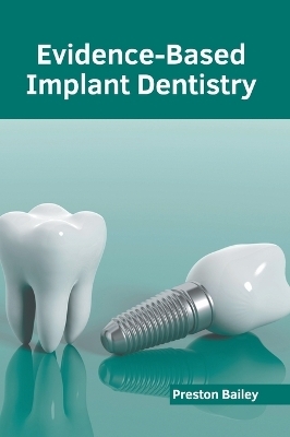 Evidence-Based Implant Dentistry - 