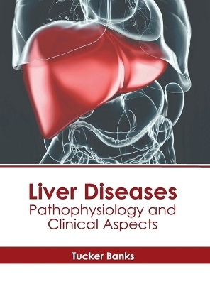 Liver Diseases: Pathophysiology and Clinical Aspects - 