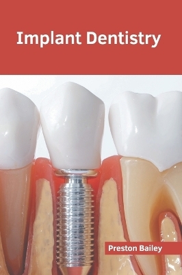 Implant Dentistry - 