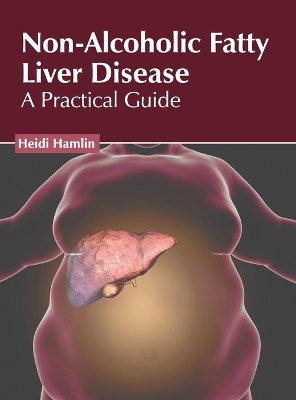 Non-Alcoholic Fatty Liver Disease: A Practical Guide - 