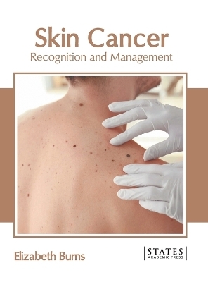 Skin Cancer: Recognition and Management - 