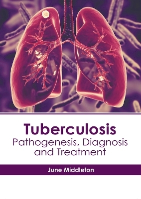 Tuberculosis: Pathogenesis, Diagnosis and Treatment - 