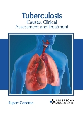 Tuberculosis: Causes, Clinical Assessment and Treatment - 