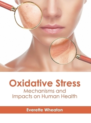 Oxidative Stress: Mechanisms and Impacts on Human Health - 