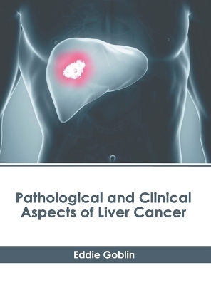 Pathological and Clinical Aspects of Liver Cancer - 