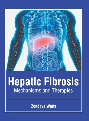 Hepatic Fibrosis: Mechanisms and Therapies - 