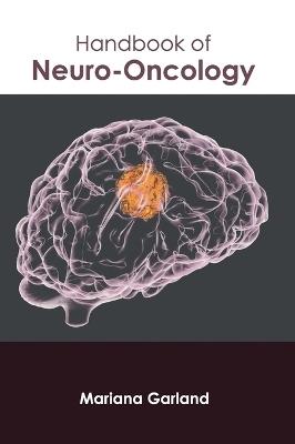 Handbook of Neuro-Oncology - 