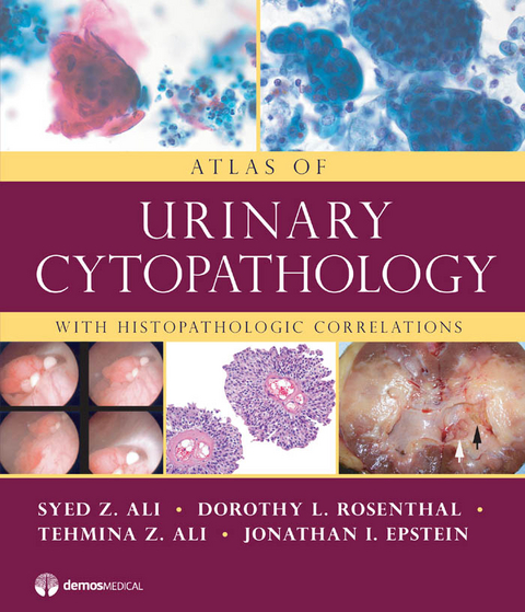 Atlas of Urinary Cytopathology - Syed Z. Ali, Tehmina Z. Ali, Jonathan I. Epstein, Dorothy L. Rosenthal