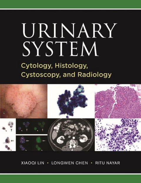 Urinary System: Cytology, Histology, Cystoscopy, and Radiology - 