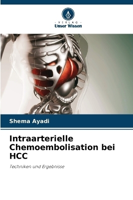 Intraarterielle Chemoembolisation bei HCC - Shema Ayadi