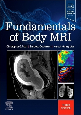 Fundamentals of Body MRI - Christopher G. Roth, Haresh Naringrekar, Sandeep Deshmukh