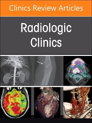 Spine Imaging and Intervention, An Issue of Radiologic Clinics of North America - 