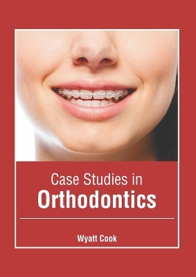 Case Studies in Orthodontics - 