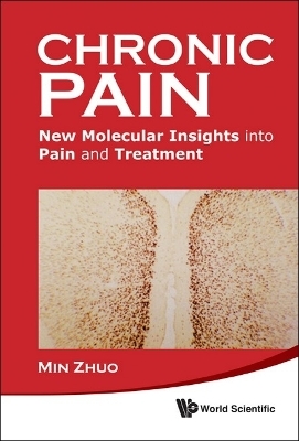 Chronic Pain: New Molecular Insights Into Pain And Treatment - Min Zhuo