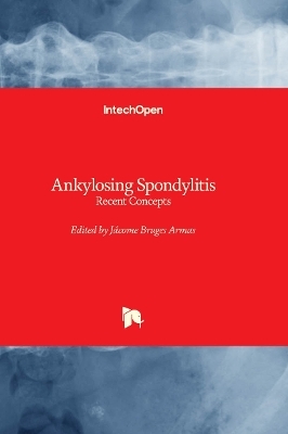 Ankylosing Spondylitis - 