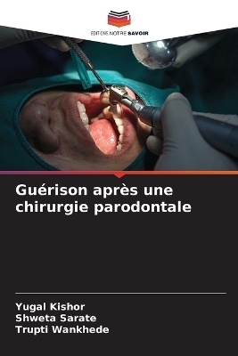 Guérison après une chirurgie parodontale - YUGAL KISHOR, Shweta Sarate, Trupti Wankhede