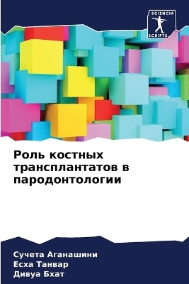 Роль костных трансплантатов в пародонтол - Сучета Аганашини, Есха Танвар, Дивуа Бхат