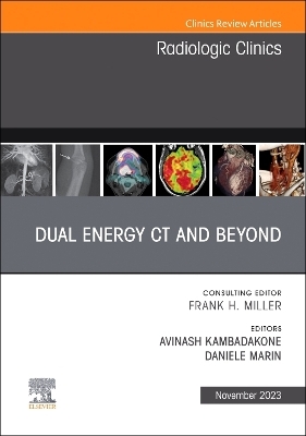 Dual Energy CT and Beyond, An Issue of Radiologic Clinics of North America - 