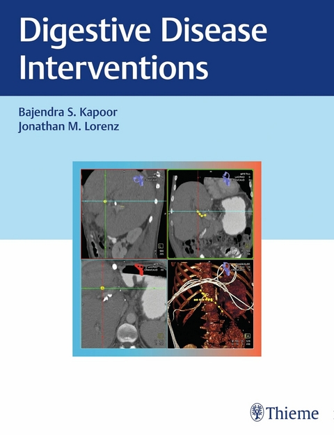 Digestive Disease Interventions -  Baljendra Kapoor,  Jonathan M. Lorenz