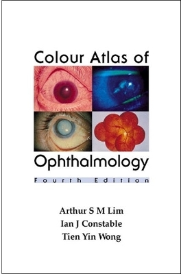 Colour Atlas Of Ophthalmology (Fourth Edition) - Arthur S M Lim, Ian J Constable