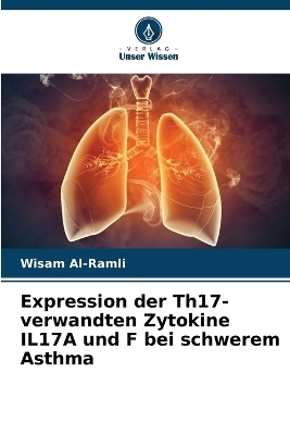 Expression der Th17-verwandten Zytokine IL17A und F bei schwerem Asthma - Wisam Al-Ramli