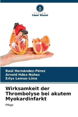 Wirksamkeit der Thrombolyse bei akutem Myokardinfarkt - Raúl Hernández-Pérez, Arnold Hdez-Núñez, Erlys Lemus-Lima