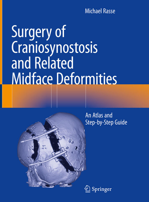 Surgery of Craniosynostosis and Related Midface Deformities - Michael Rasse