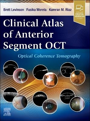 Clinical Atlas of Anterior Segment OCT: Optical Coherence Tomography - 