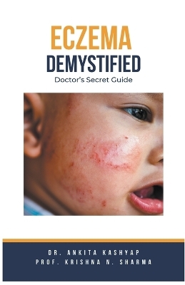 Eczema Demystified - Dr Ankita Kashyap, Prof Krishna N Sharma