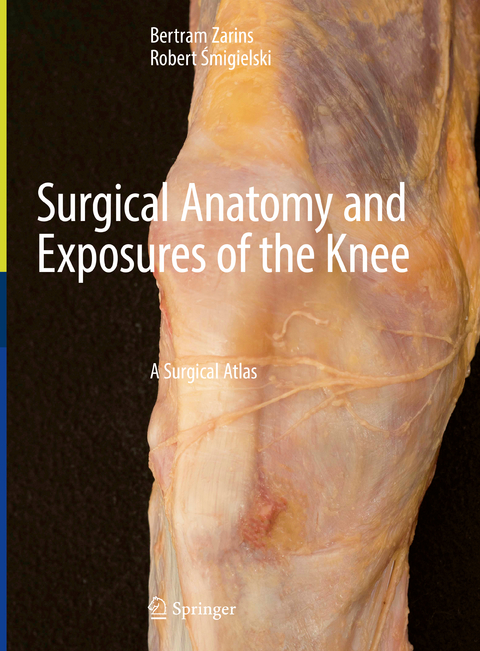 Surgical Anatomy and Exposures of the Knee - 