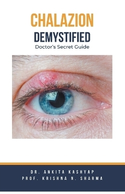 Chalazion Demystified - Dr Ankita Kashyap, Prof Krishna N Sharma