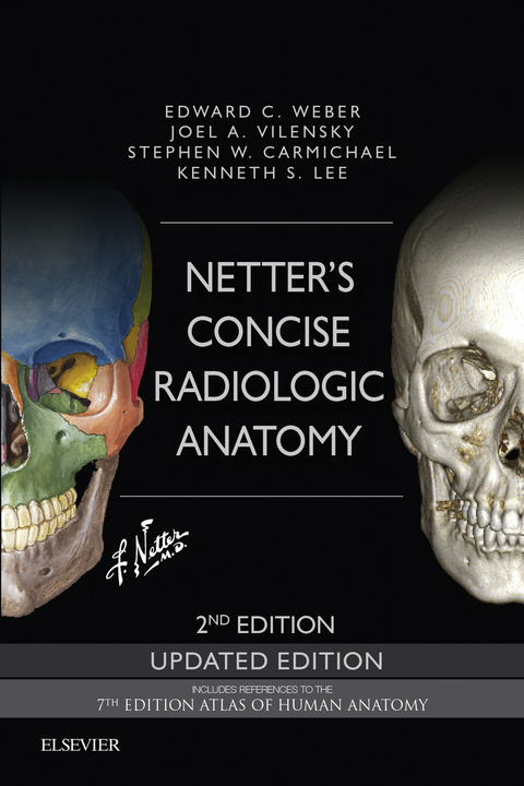 Netter's Concise Radiologic Anatomy Updated Edition E-Book -  Stephen W. Carmichael,  Joel A. Vilensky,  Edward C. Weber