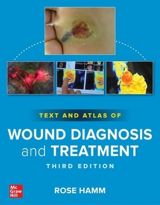 Text and Atlas of Wound Diagnosis and Treatment, Third Edition - Rose Hamm