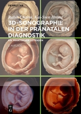 3D-Sonographie in der pränatalen Diagnostik - Rabih Chaoui, Kai-Sven Heling