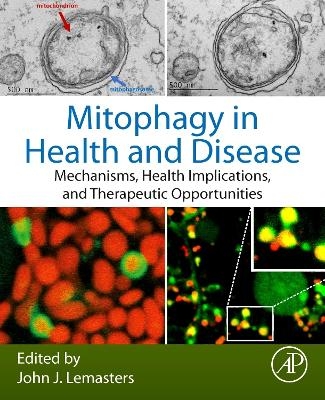 Mitophagy in Health and Disease - 