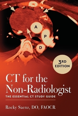 Ct for the Non-Radiologist -  Saenz R