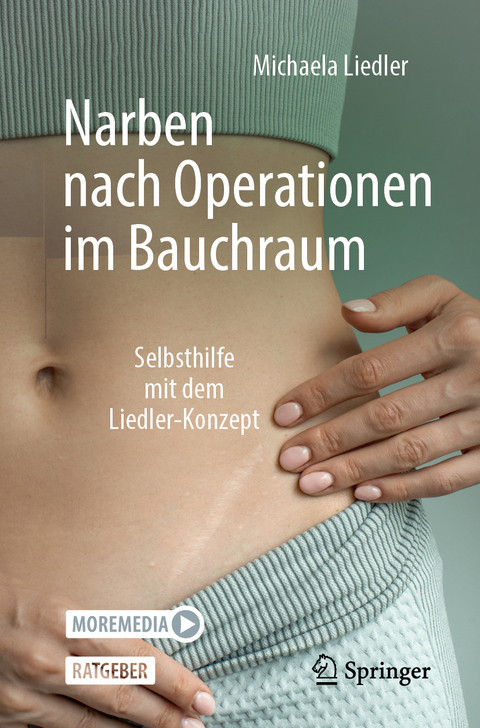 Narben nach Operationen im Bauchraum - Michaela Liedler